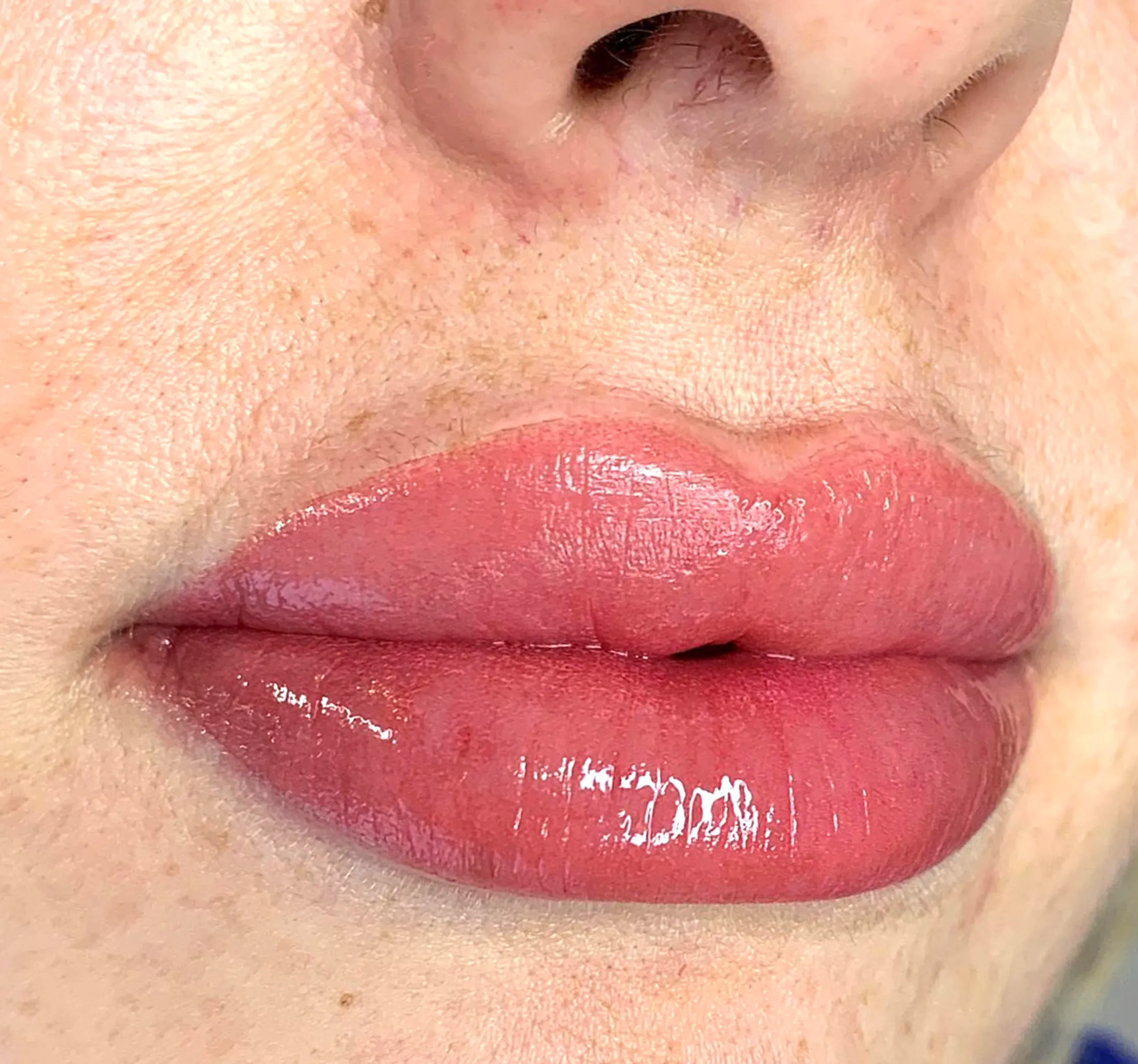filler impact on lip tattoo