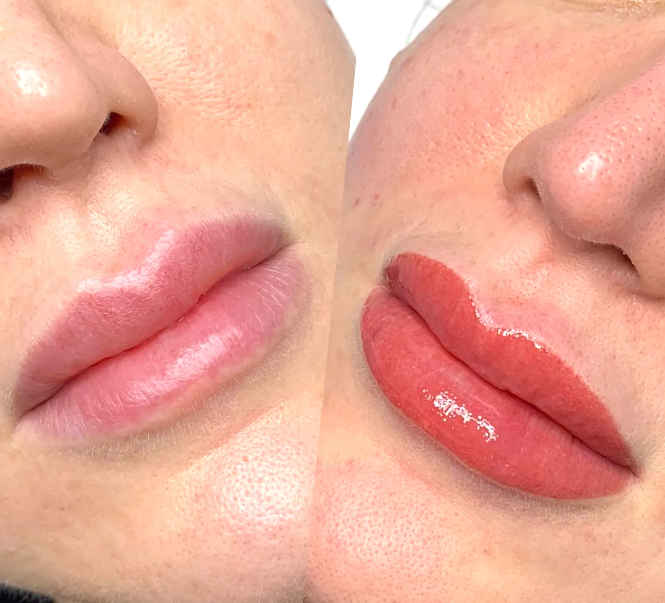 wait time lip filler to tattoo