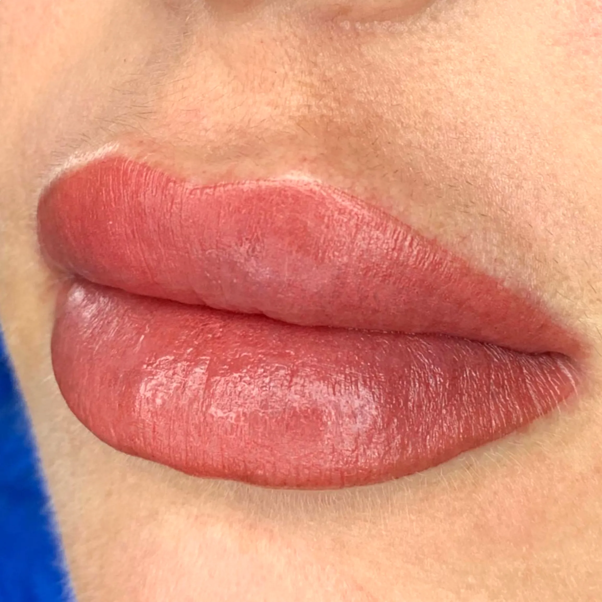 Lip Blushing After Fillers